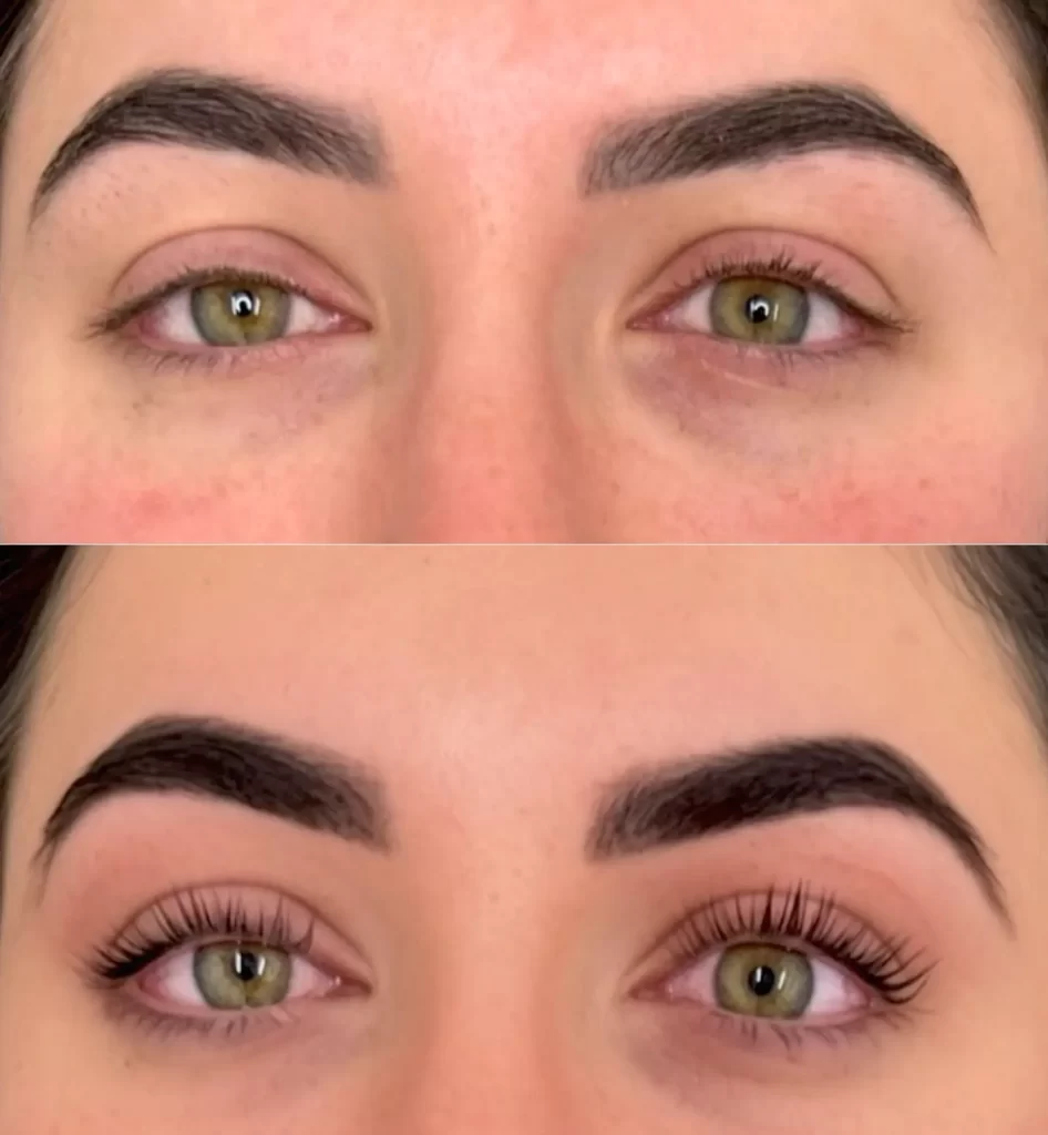 Microblading