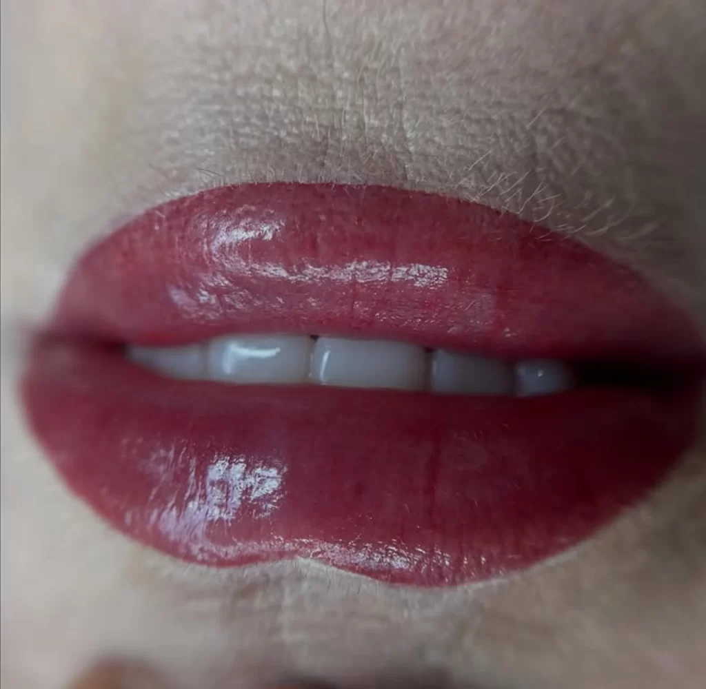 Can You Go Out in the Sun After a Lip Blush Procedure?