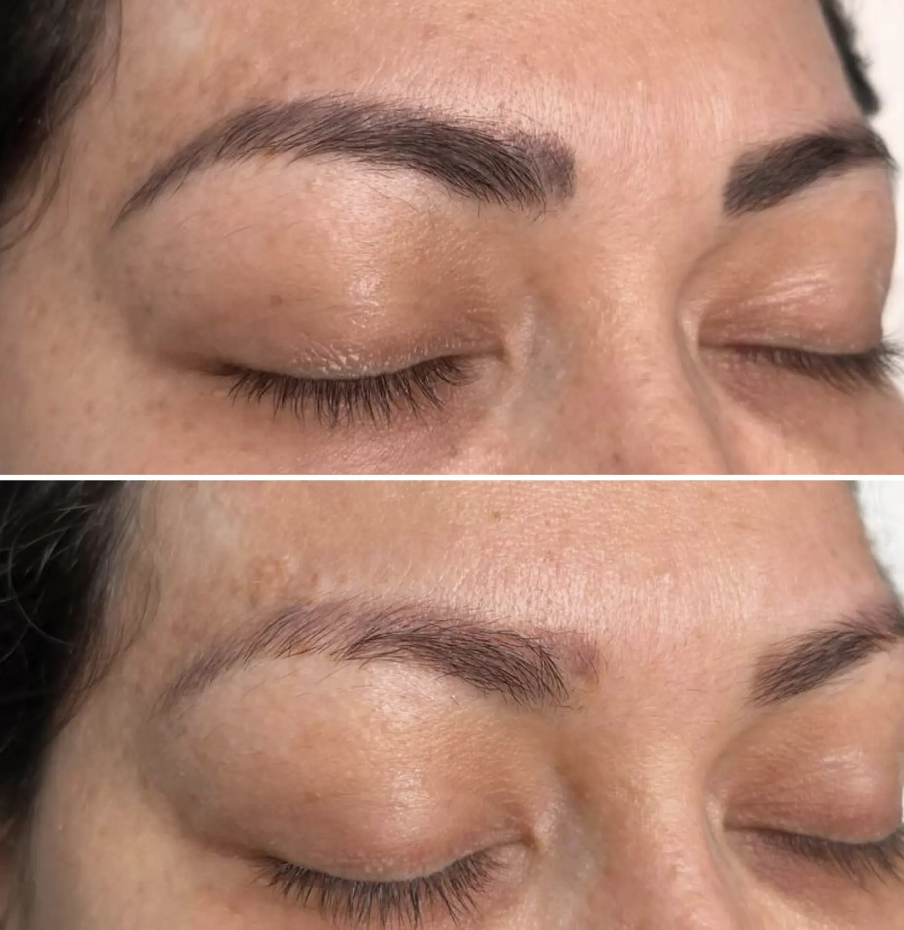 DIY tattoo removal