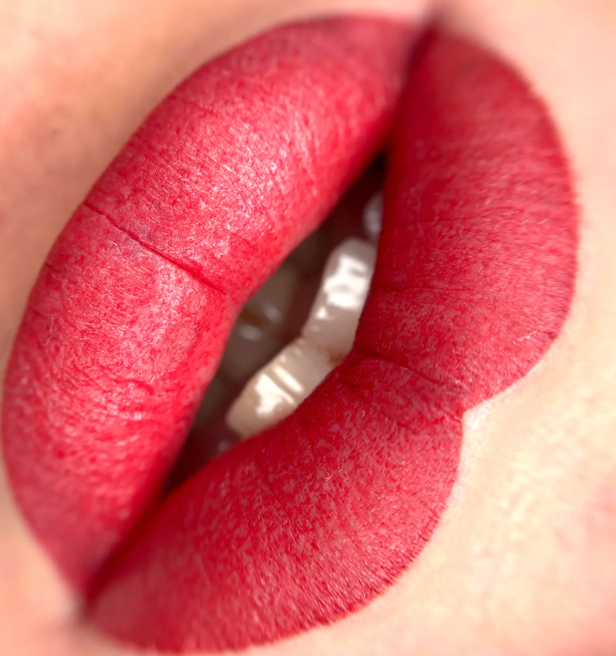 infection prevention skin penetration